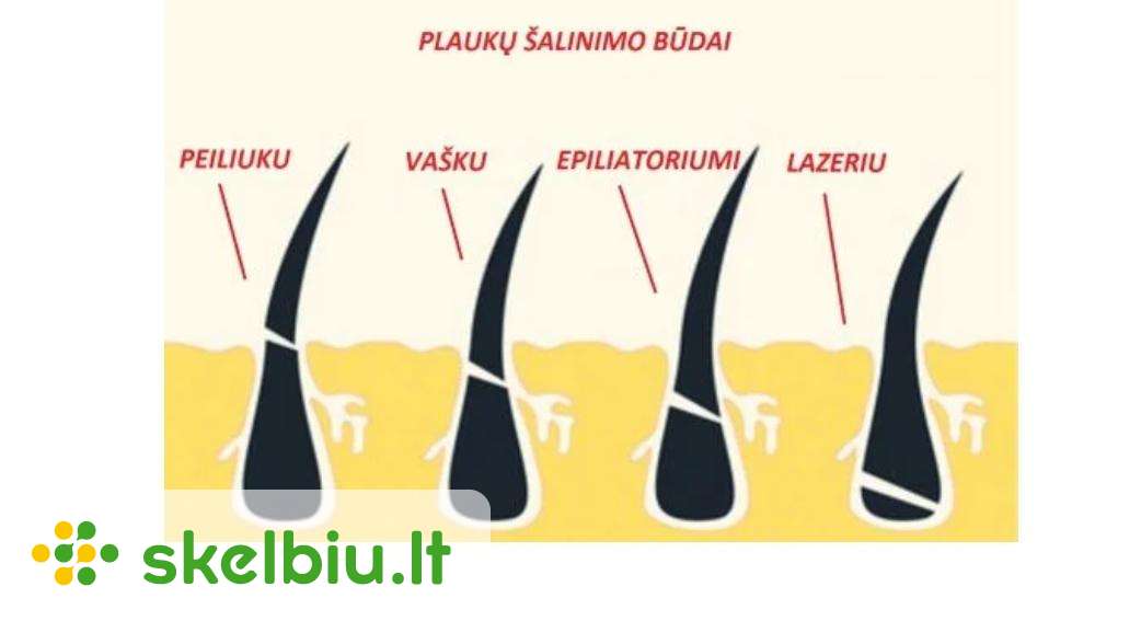 plauk-alinimas-ipl-lazeriu-akcija-tik-18-19d-skelbiu-lt