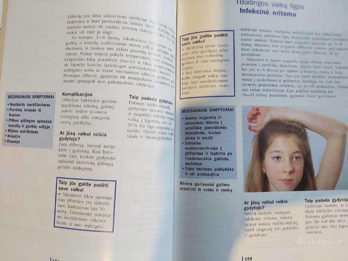 Knyga ,Vaikų ligos" - nuotraukos Nr. 6