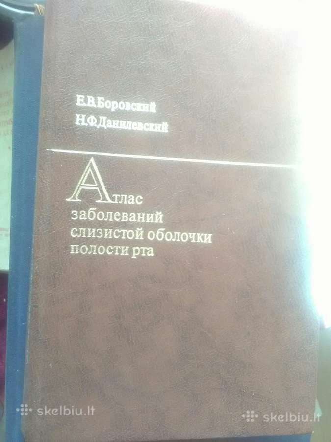 Atlas zabolevanii slizistoi obolocka polosti rta