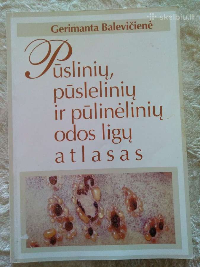 Pūslinių, pūslelinių ir pūlinėlinių odos atlasas