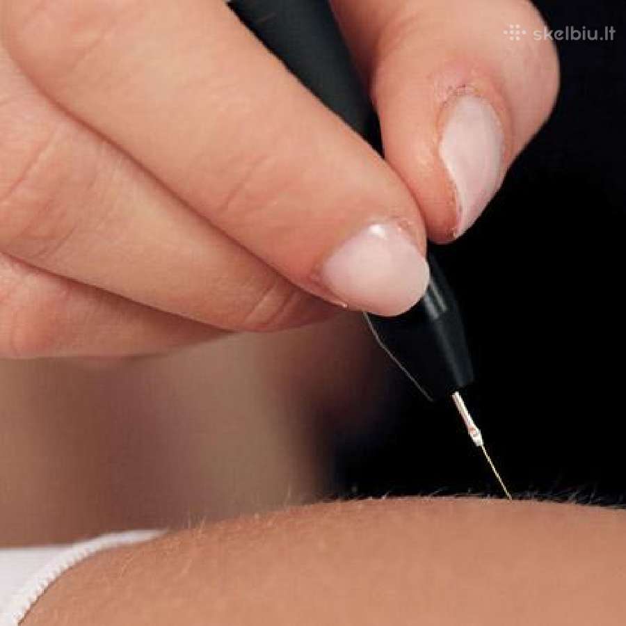 Radijo dažnio aparatai veidui ir kūnui nuo 7600eur - nuotraukos Nr. 5