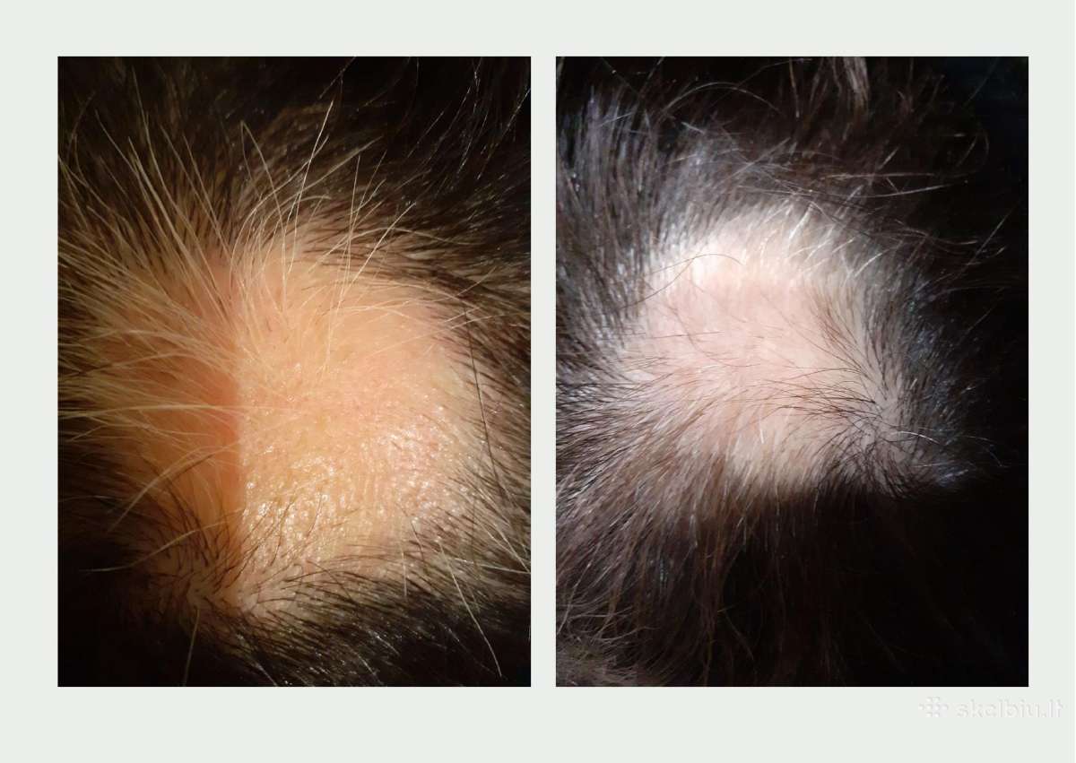 Plaukų kaukė „Hair Mask Alv“- pagalba plaukams - nuotraukos Nr. 6