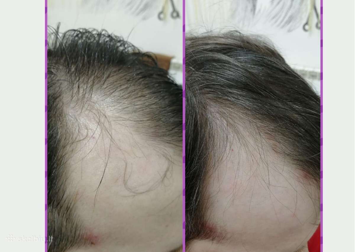 Plaukų kaukė „Hair Mask Alv“- pagalba plaukams - nuotraukos Nr. 2