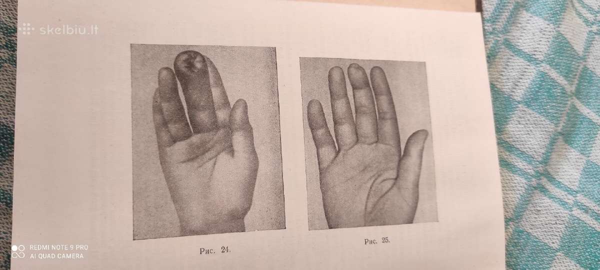 Senoviškos vertingos medicinines knygos - nuotraukos Nr. 8