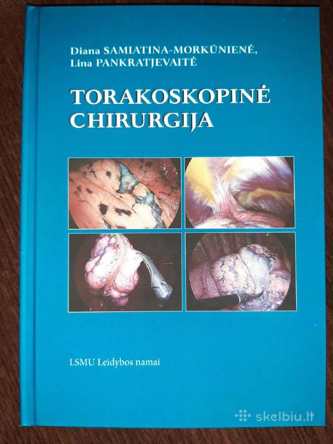 Torakoskopinė Chirurgija