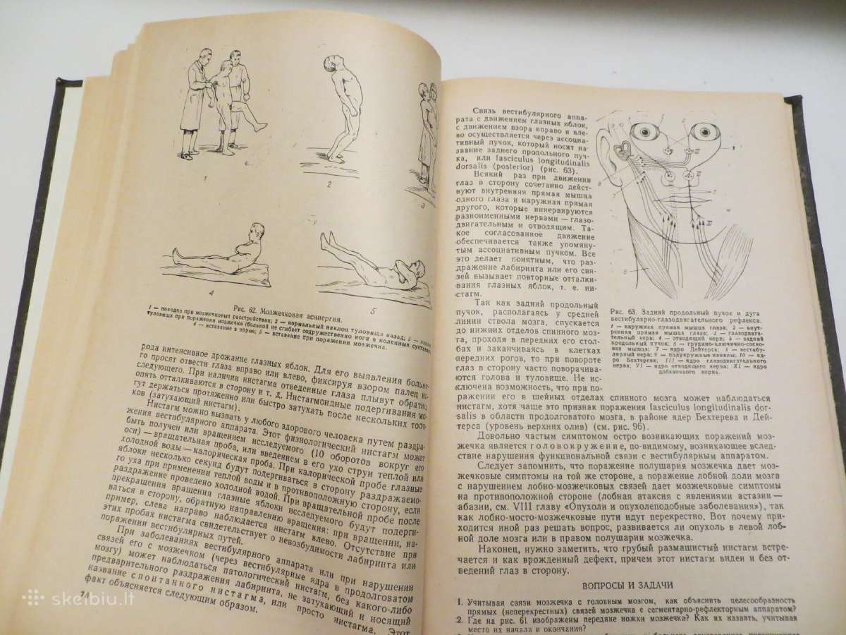 Knyga Nervų ligos V.v. Micheev, 1974 m. - nuotraukos Nr. 12