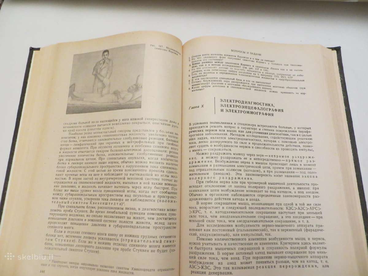 Knyga Nervų ligos V.v. Micheev, 1974 m. - nuotraukos Nr. 16