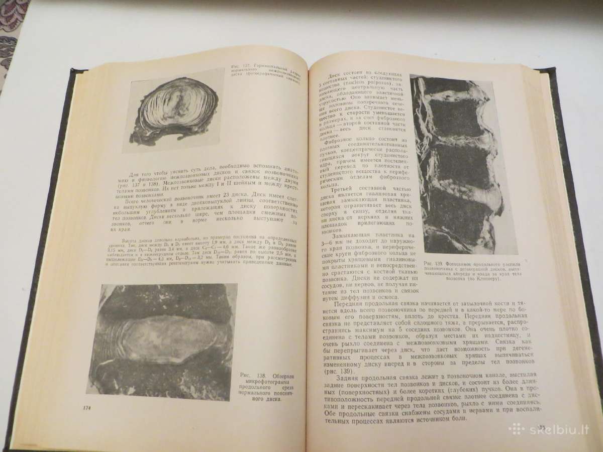 Knyga Nervų ligos V.v. Micheev, 1974 m. - nuotraukos Nr. 18