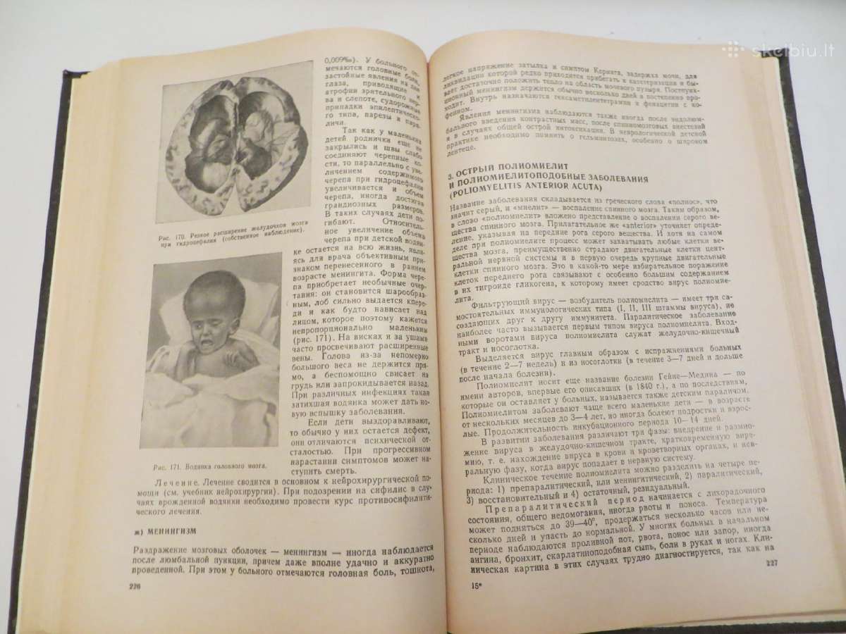 Knyga Nervų ligos V.v. Micheev, 1974 m. - nuotraukos Nr. 20