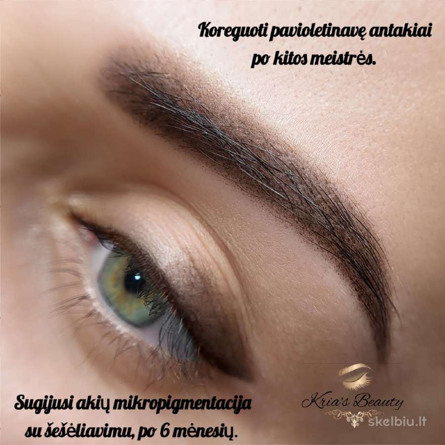 Nekokybiško permanentinio makiažo šalinimas - nuotraukos Nr. 19