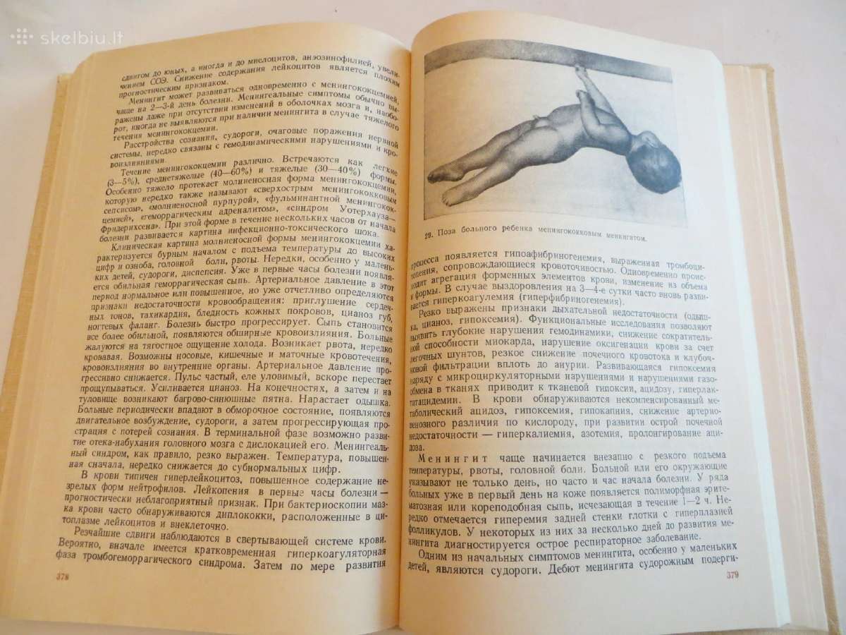 Knyga Infekcinių ligų vadovas. Gydymas. 1986 - nuotraukos Nr. 29
