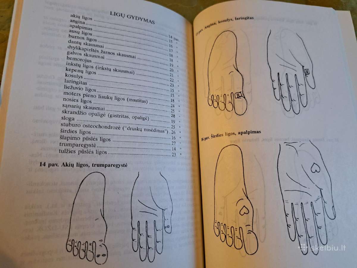Netradiciniai gydymo metodai - nuotraukos Nr. 8