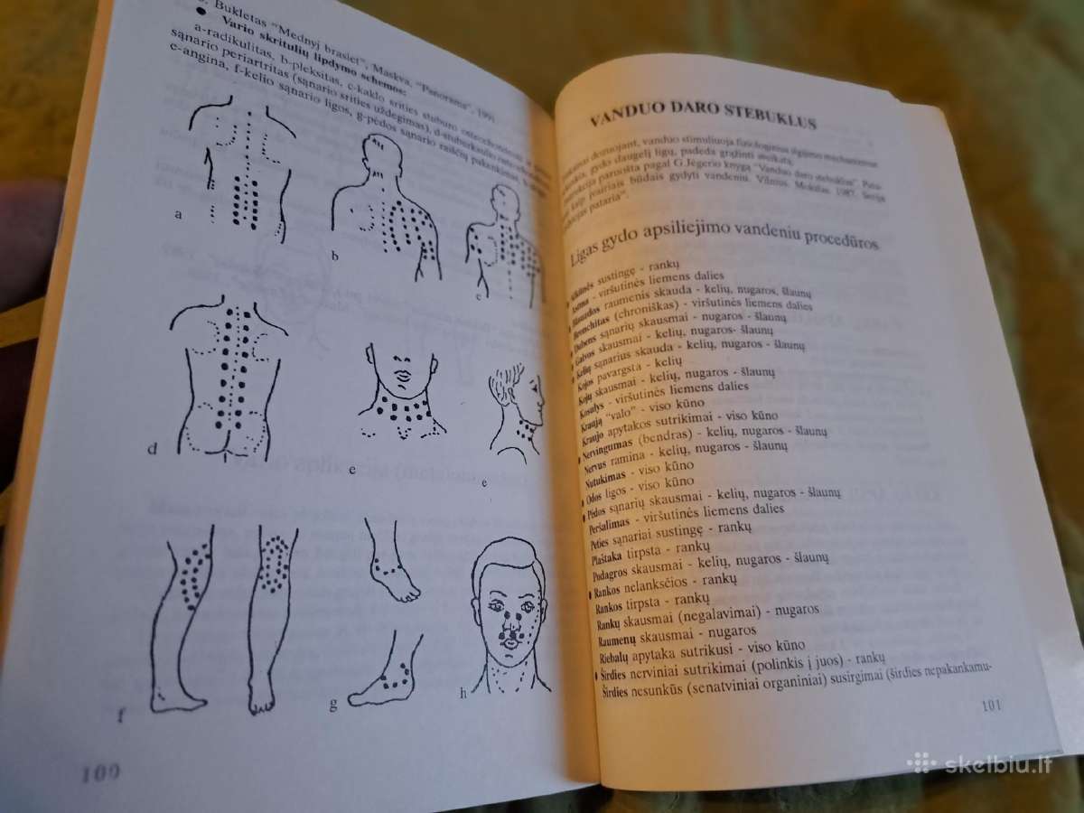 Netradiciniai gydymo metodai - nuotraukos Nr. 11