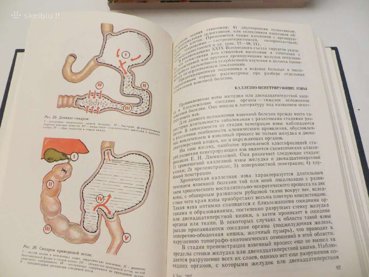 Knyga Praktiniai nurodymai, chirurginės ligos 1983 - nuotraukos Nr. 16