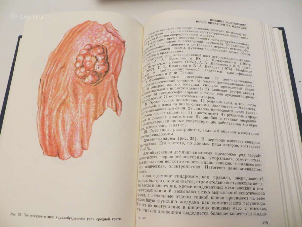 Knyga Praktiniai nurodymai, chirurginės ligos 1983 - nuotraukos Nr. 18