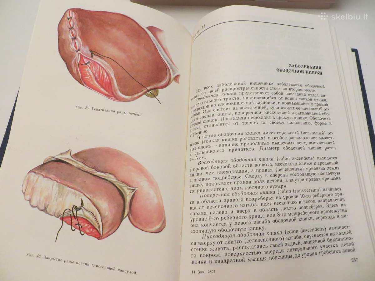 Knyga Praktiniai nurodymai, chirurginės ligos 1983 - nuotraukos Nr. 19