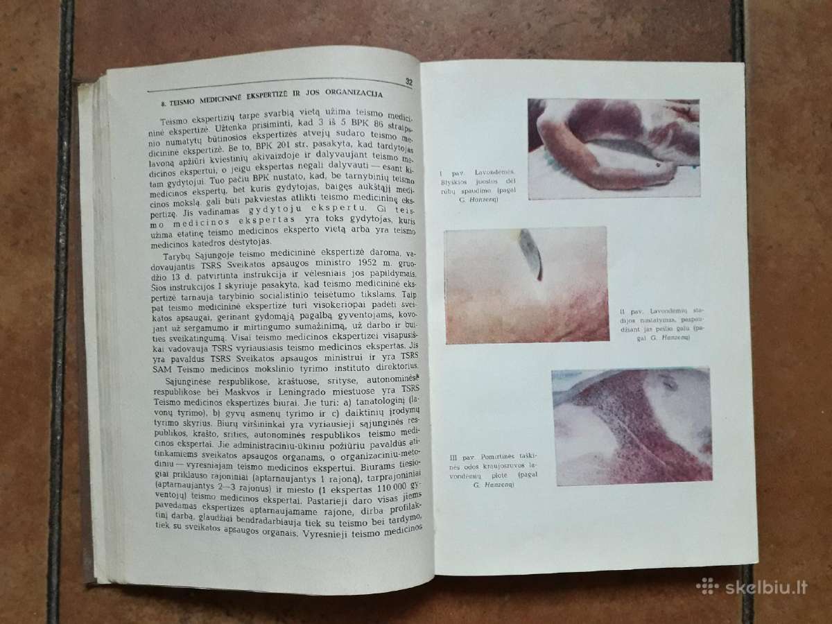 J. Markulis, J. Nainys "Teismo medicina" 1969 m. - nuotraukos Nr. 6