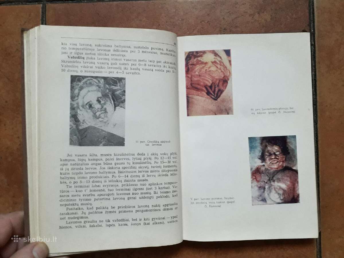 J. Markulis, J. Nainys "Teismo medicina" 1969 m. - nuotraukos Nr. 7