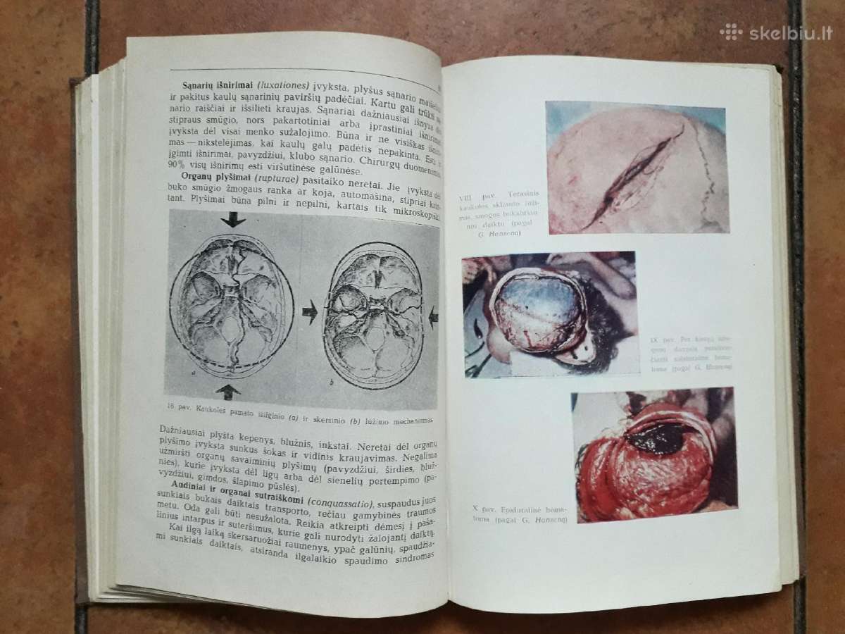 J. Markulis, J. Nainys "Teismo medicina" 1969 m. - nuotraukos Nr. 8