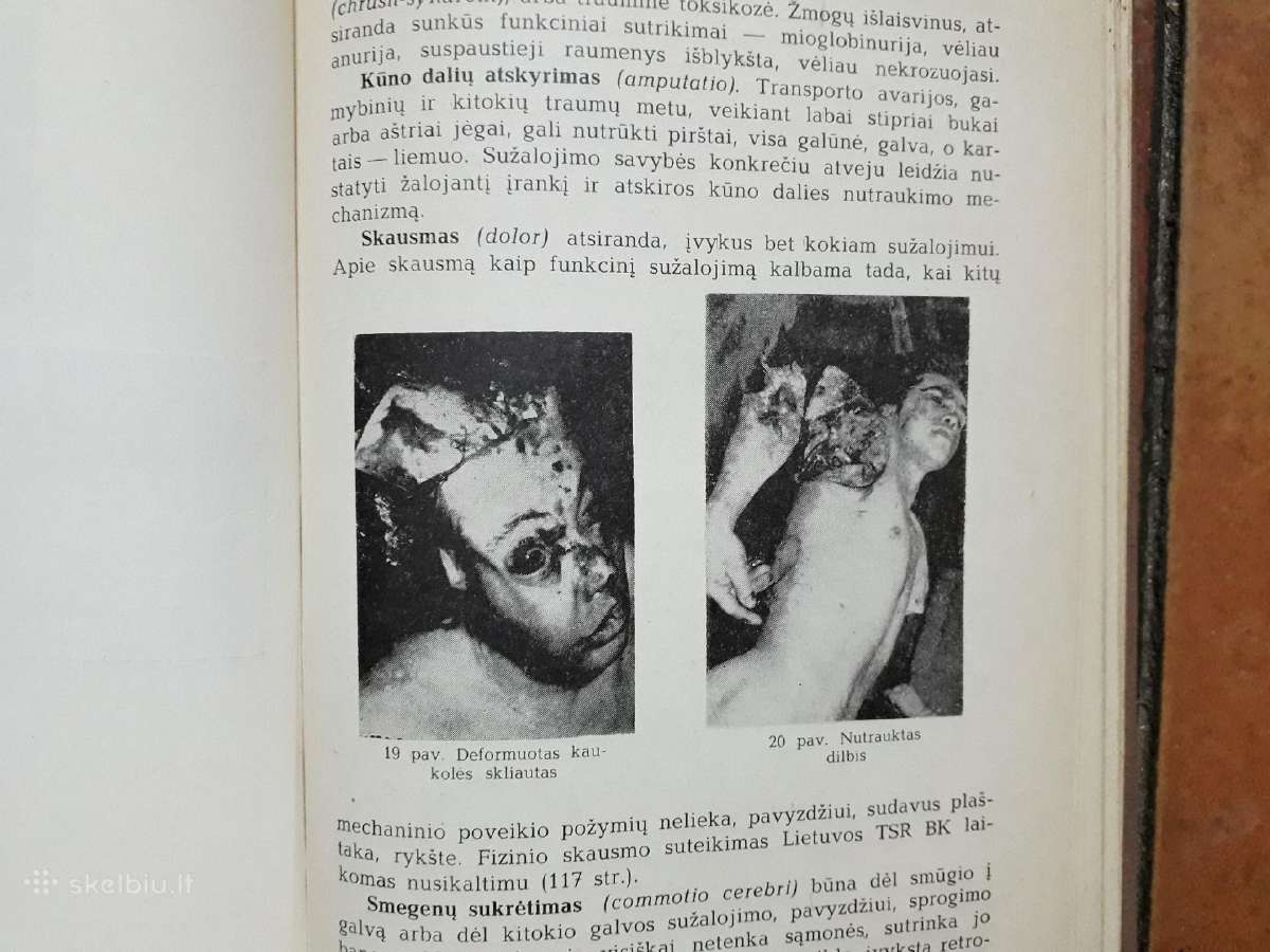 J. Markulis, J. Nainys "Teismo medicina" 1969 m. - nuotraukos Nr. 9