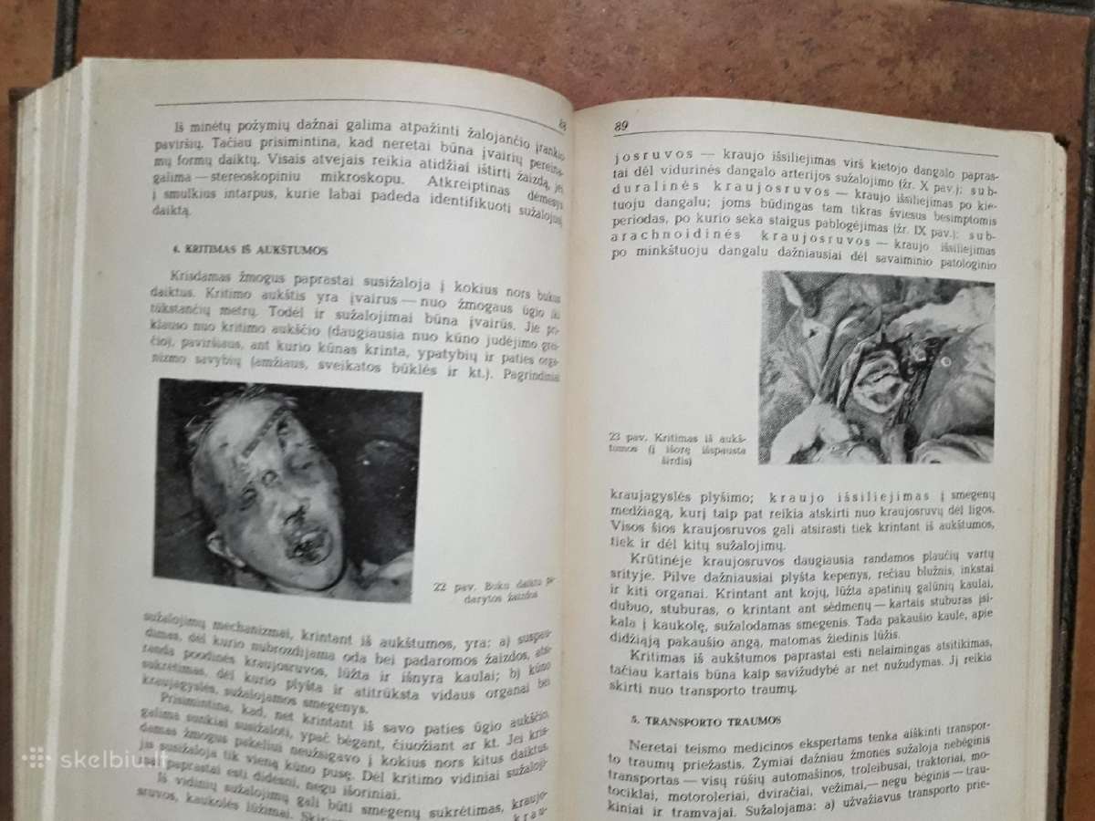 J. Markulis, J. Nainys "Teismo medicina" 1969 m. - nuotraukos Nr. 10