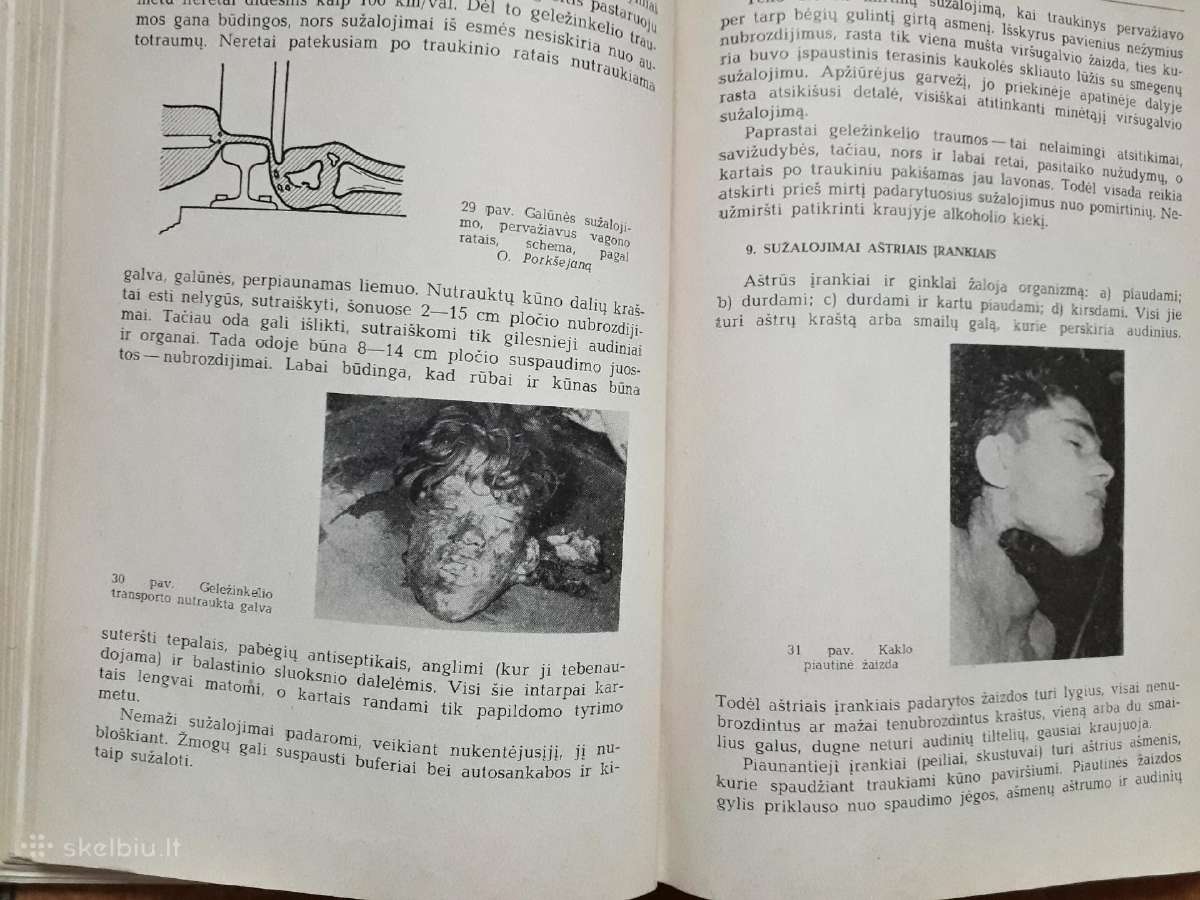 J. Markulis, J. Nainys "Teismo medicina" 1969 m. - nuotraukos Nr. 11