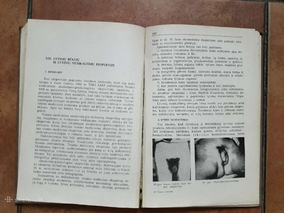 J. Markulis, J. Nainys "Teismo medicina" 1969 m. - nuotraukos Nr. 12
