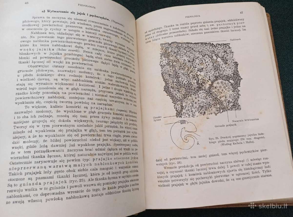 Sena knyga 1923 m. Ginekologija 404 p. 171 iliust. - nuotraukos Nr. 5