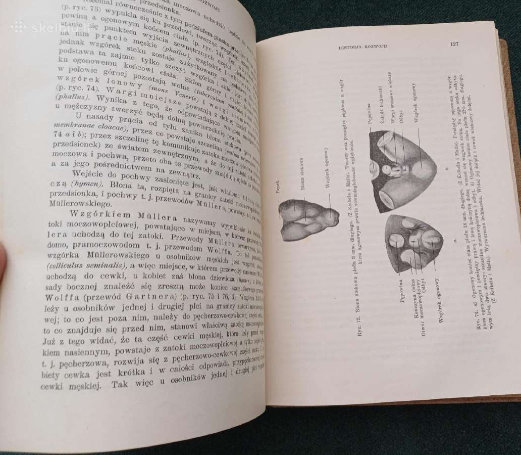 Sena knyga 1923 m. Ginekologija 404 p. 171 iliust. - nuotraukos Nr. 6