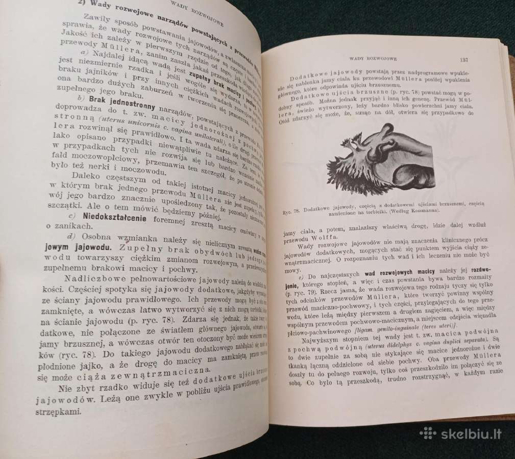 Sena knyga 1923 m. Ginekologija 404 p. 171 iliust. - nuotraukos Nr. 9