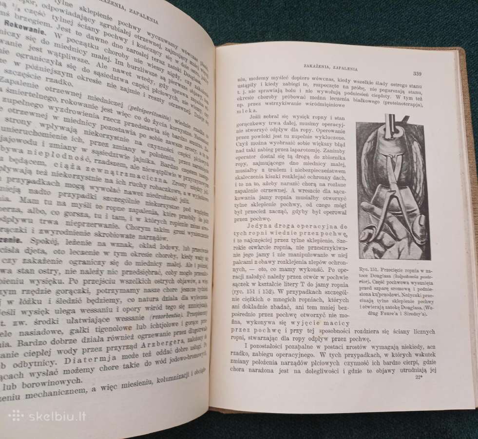 Sena knyga 1923 m. Ginekologija 404 p. 171 iliust. - nuotraukos Nr. 10