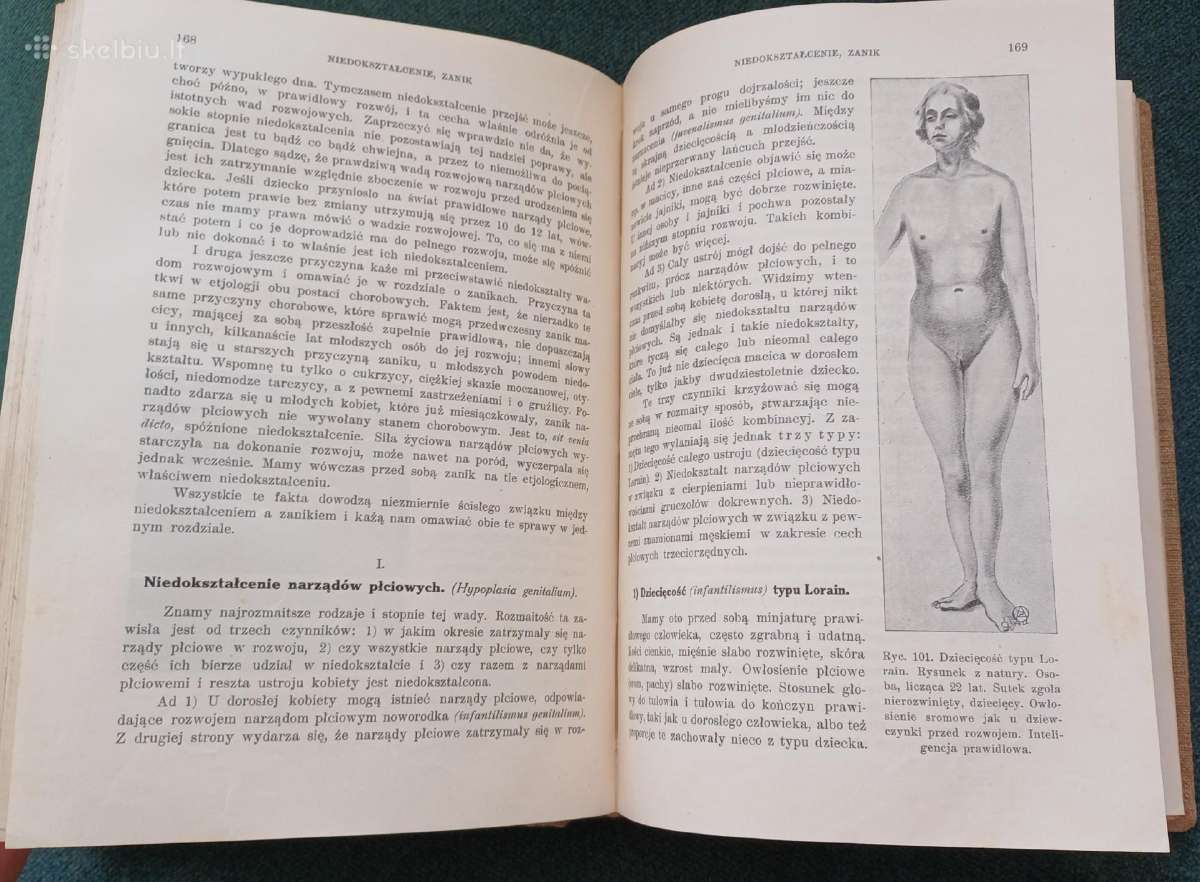 Sena knyga 1923 m. Ginekologija 404 p. 171 iliust. - nuotraukos Nr. 12