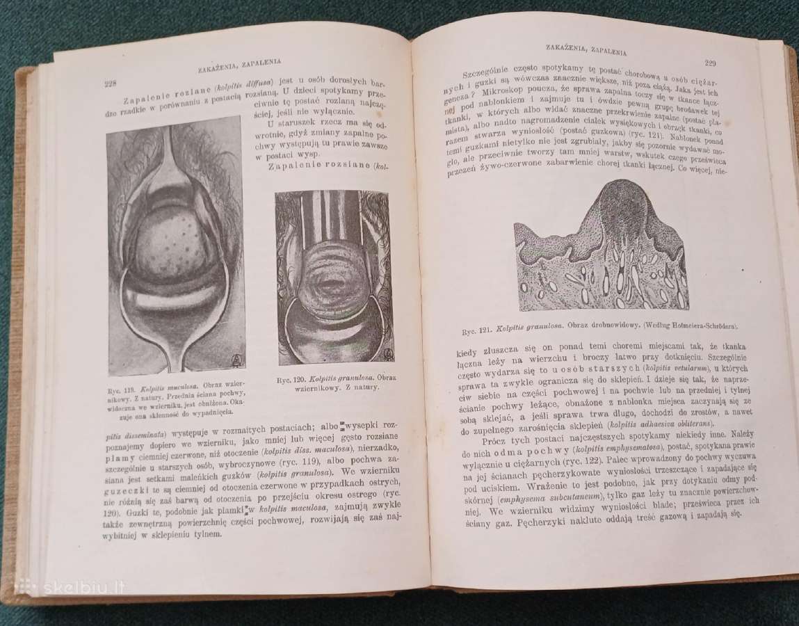Sena knyga 1923 m. Ginekologija 404 p. 171 iliust. - nuotraukos Nr. 17
