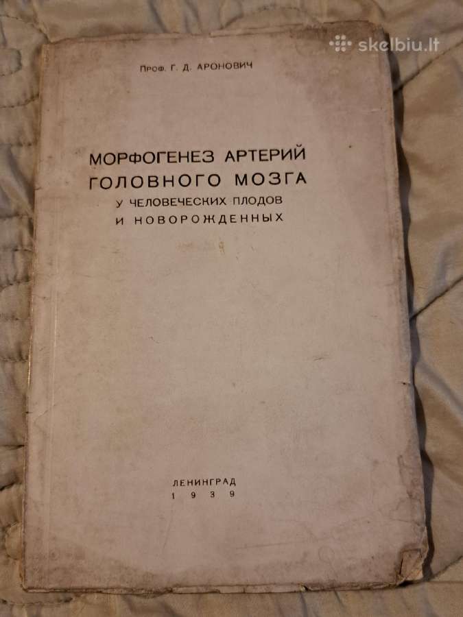 Smegenų arterijų morfogenezė