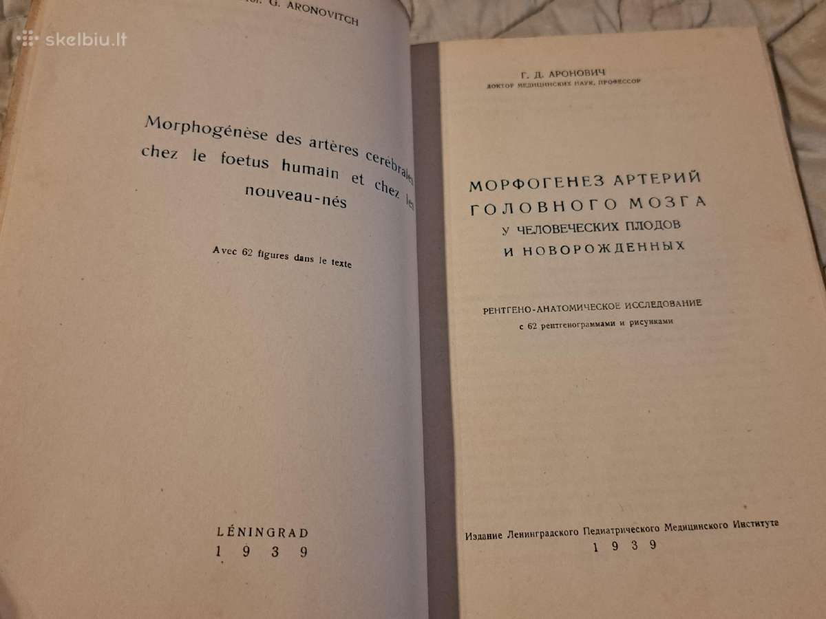 Smegenų arterijų morfogenezė - nuotraukos Nr. 2