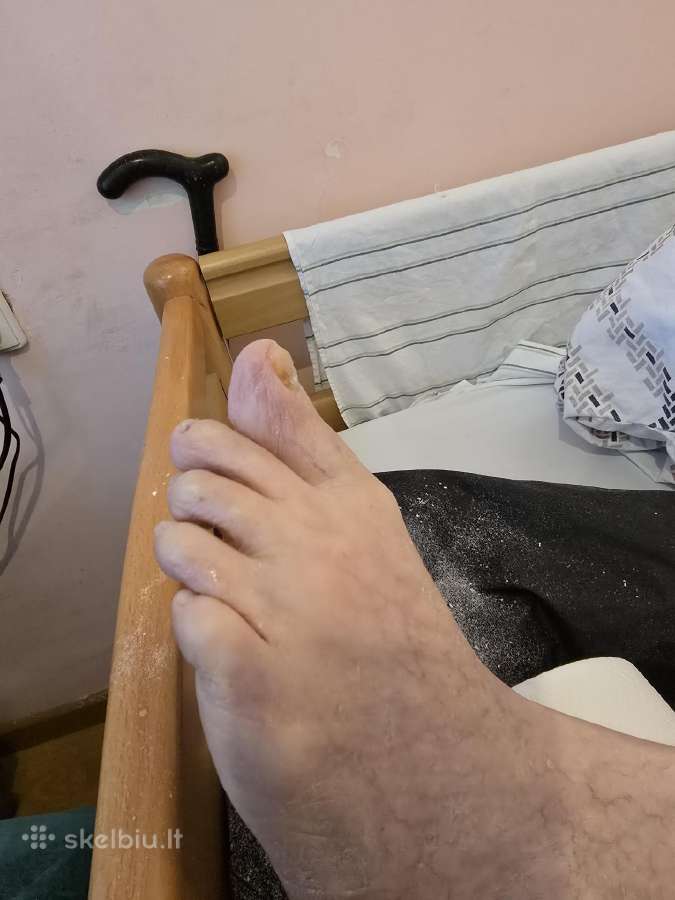 Probleminių nagų bei padų tvarkymas jūsų namuose - nuotraukos Nr. 37