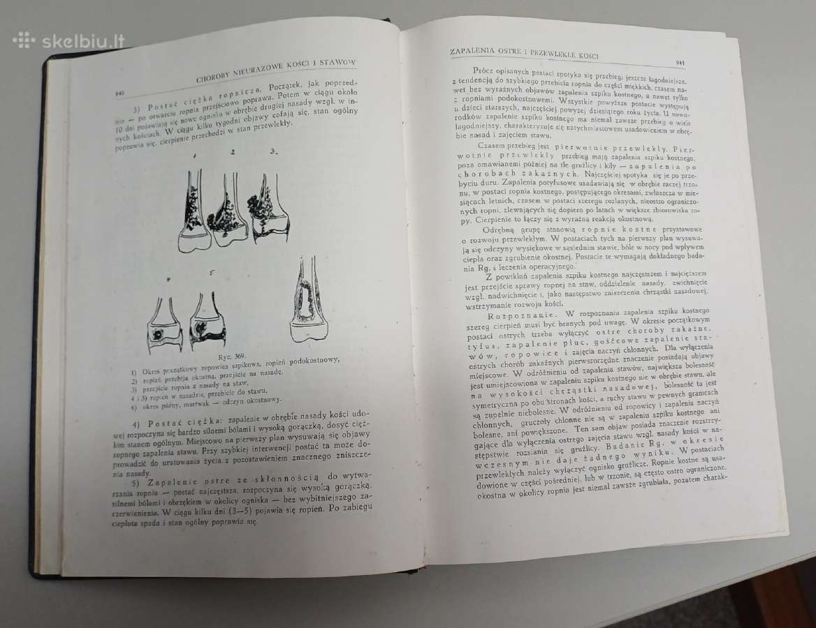 Chirurgijos vadovėlis 1937 m. Lenkija - nuotraukos Nr. 8