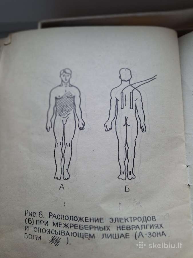 El.stimuliatorius*элиман-206*individual naudojimui - nuotraukos Nr. 8
