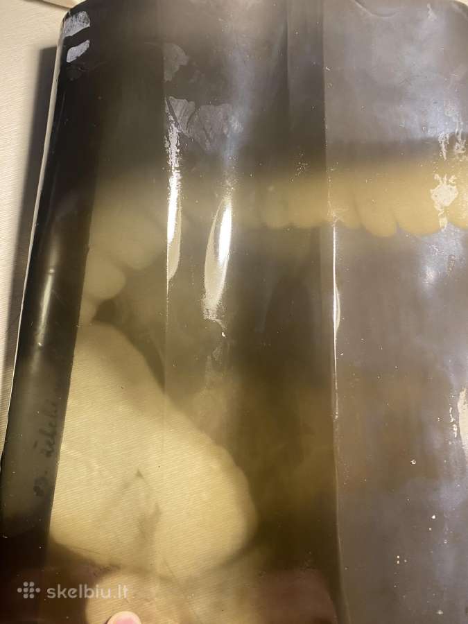 Parduodamos rentgeno nuotraukos