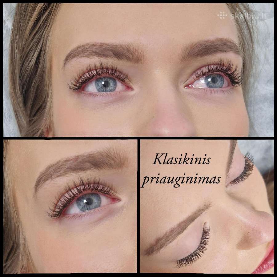 Blakstienos/antakiai Depiliacijos - nuotraukos Nr. 15