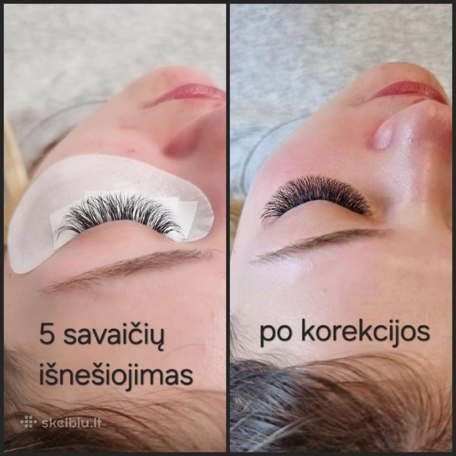 Blakstienos/antakiai Depiliacijos - nuotraukos Nr. 16