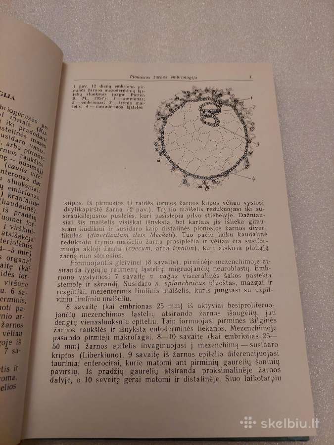 Plonosios žarnos ligos ir malabsorbcijos sindromas - nuotraukos Nr. 4