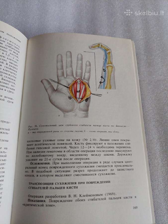 Оперативная хирургия детского возраста - nuotraukos Nr. 5