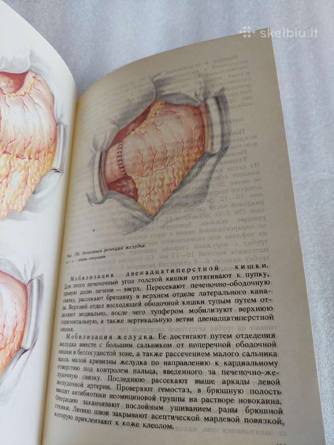 Оперативная хирургия детского возраста - nuotraukos Nr. 6