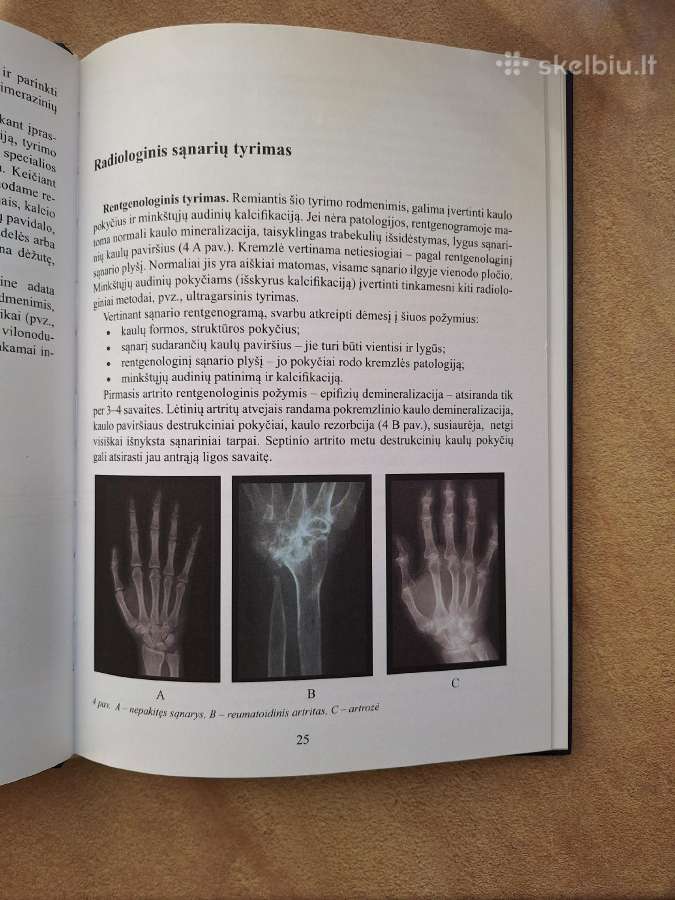 Reumatologijos pagrindai - nuotraukos Nr. 3