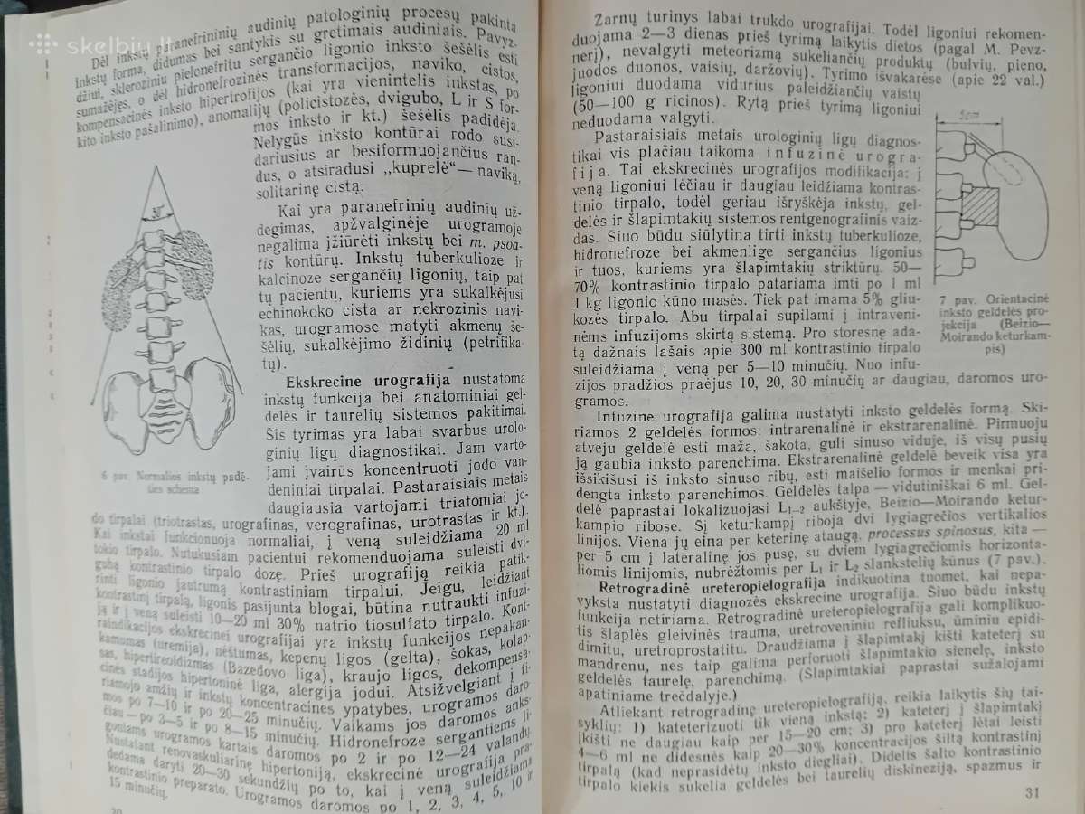 Cerebralinis Arachnoiditas, Urologija - nuotraukos Nr. 4