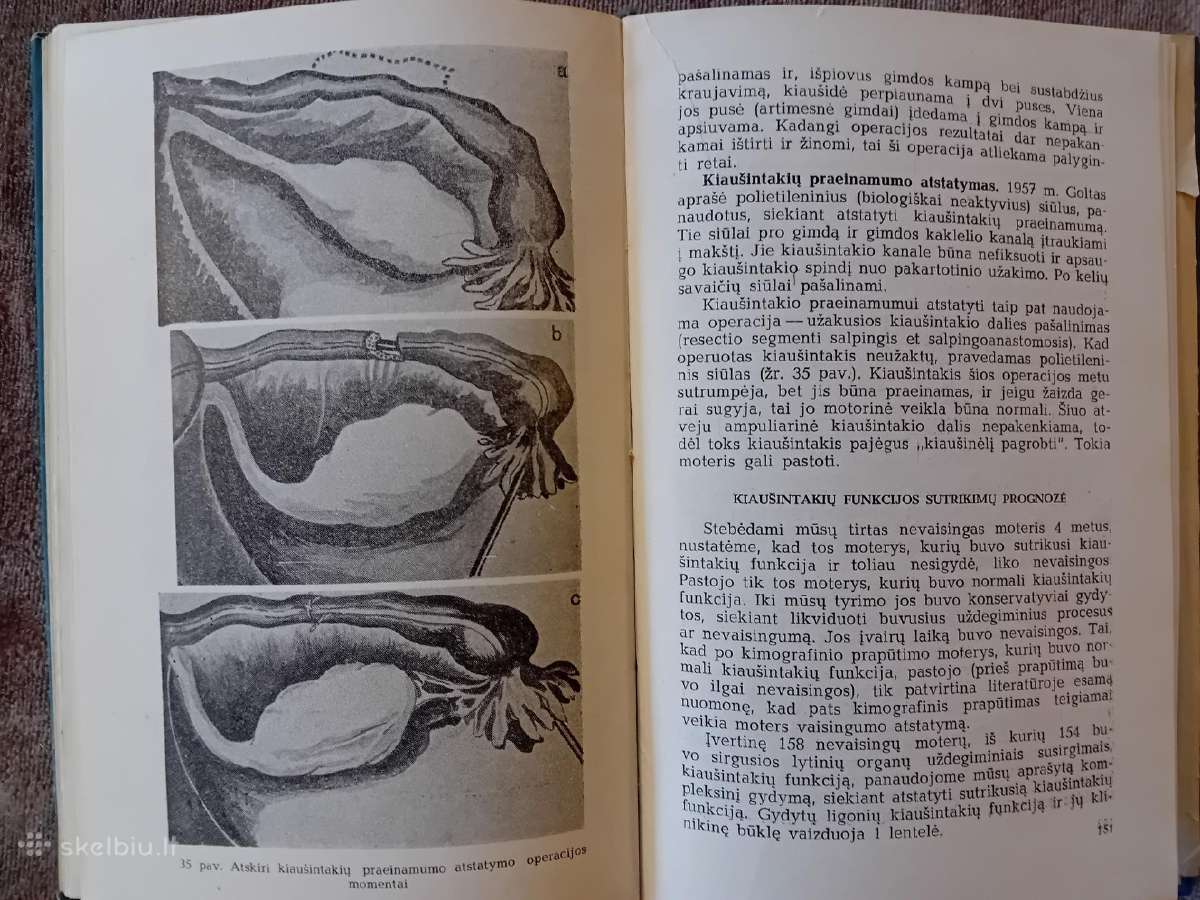 Šeimų vaisingumo sutrikimai - nuotraukos Nr. 6