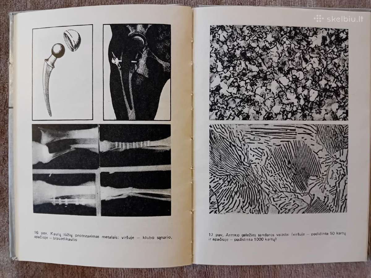 V. Janulis "Metalai ir mes" 1986 m. - nuotraukos Nr. 5