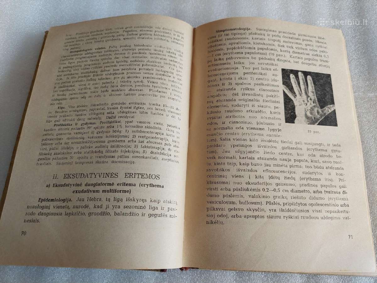 Trumpas odos ligų kursas - nuotraukos Nr. 3