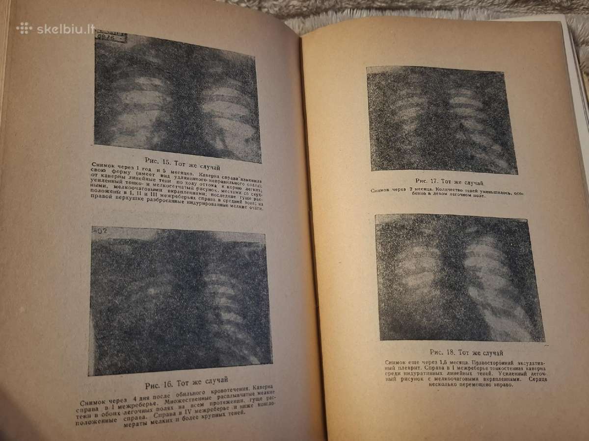 Medicina - nuotraukos Nr. 17